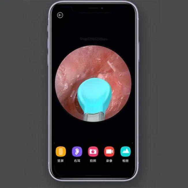 گوش پاک‌کن هوشمند شیائومی BEBIRD مدل Xiaomi M9 Pro image gallery